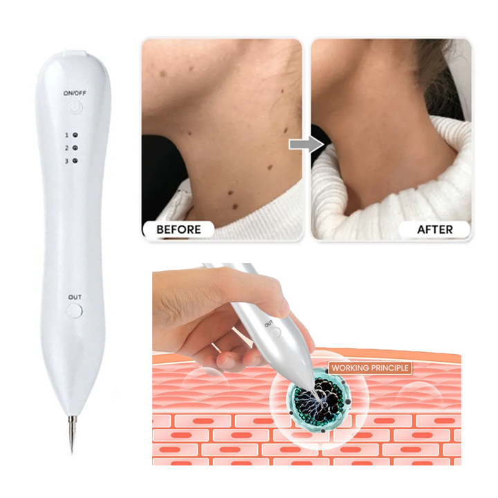 Advanced Plasma Laser Spot Cleaning Pen