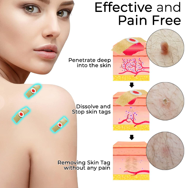 Skin Tags & Mole Aftercare Protecting Patch PRO