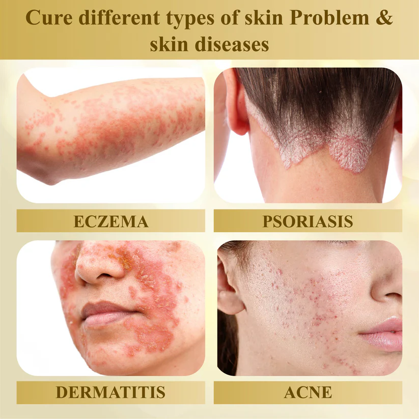 Condense Mellifera Venom Skin Repairing Cream