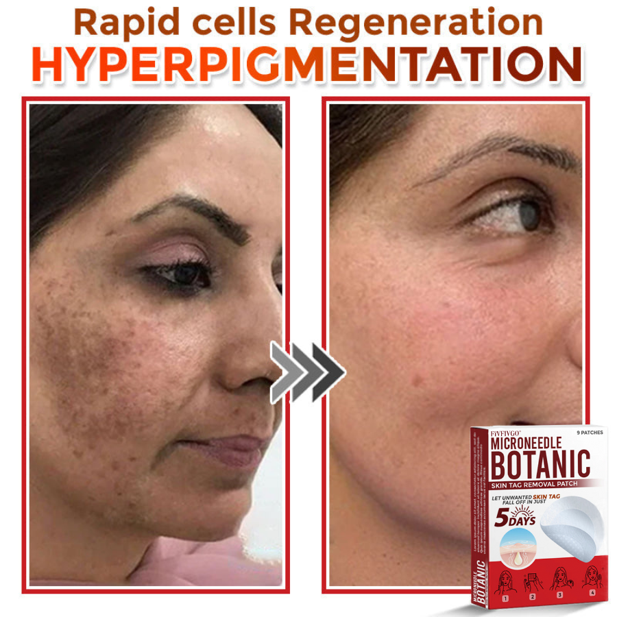 MicroNeedle Botanic Skin Tag Removal Patch 🇺🇸 Made in the USA