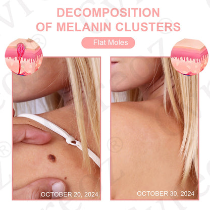 Dual Acid Wart & Mole Removal Serum