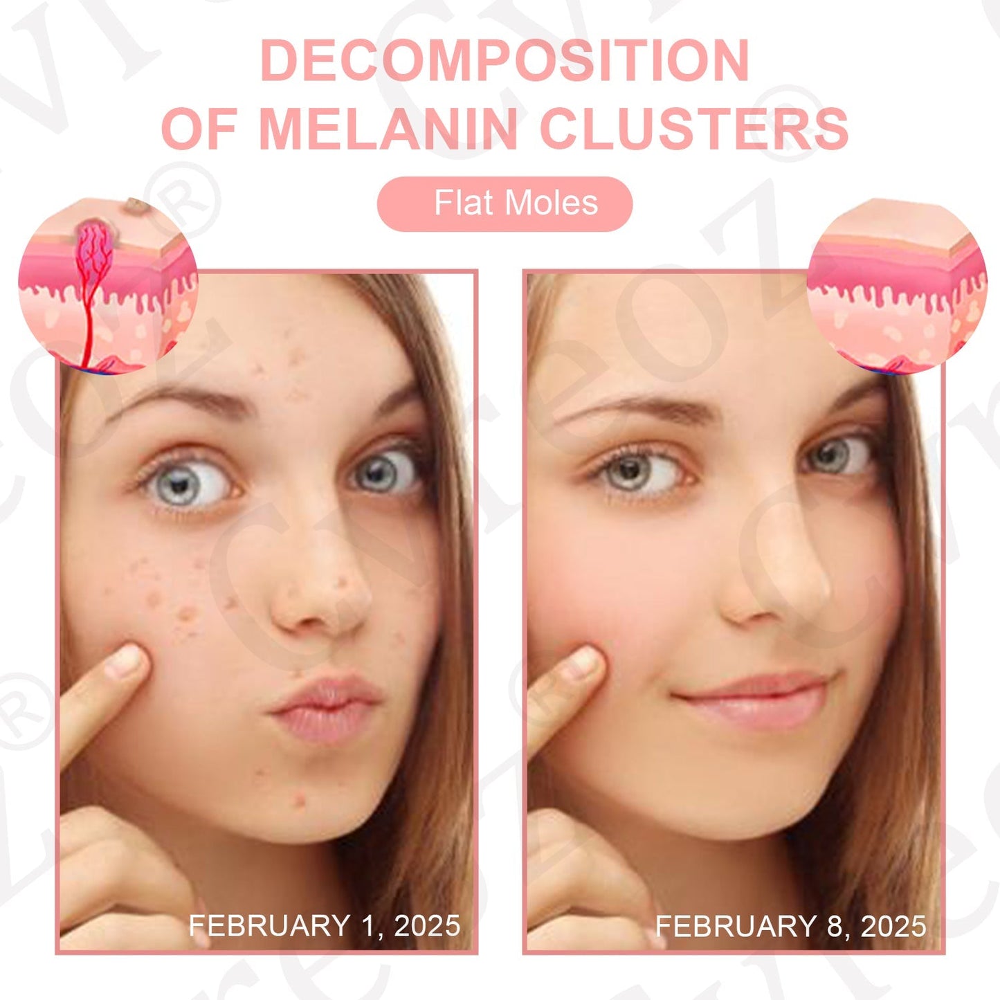 Dual Acid Wart & Mole Removal Serum