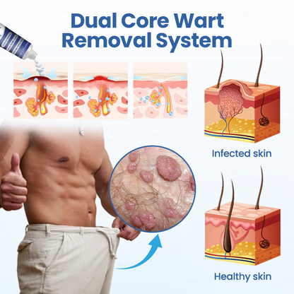 GentX WartRelief Cream