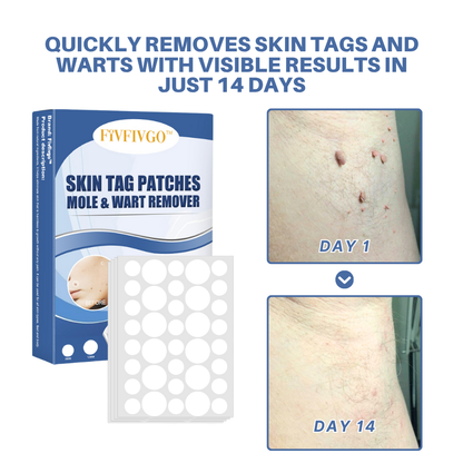 Moles & Warts Removing Skin Tag Patch