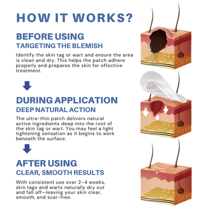 Moles & Warts Removing Skin Tag Patch