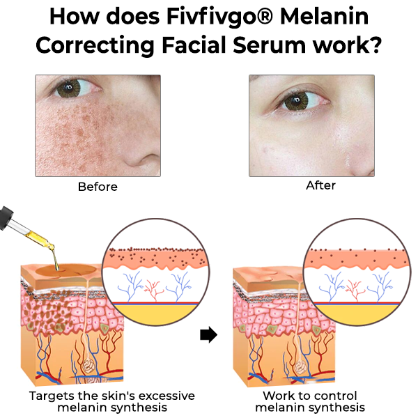 Melanin Correcting Facial Serum