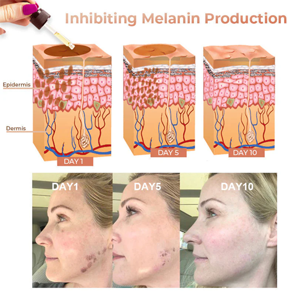 Melanin Correcting Facial Serum