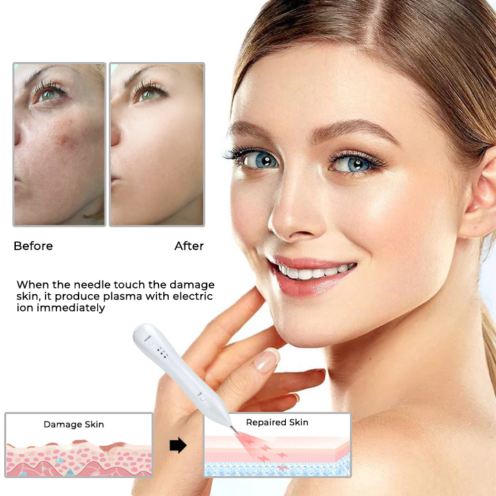 Advanced Plasma Laser Spot Cleaning Pen