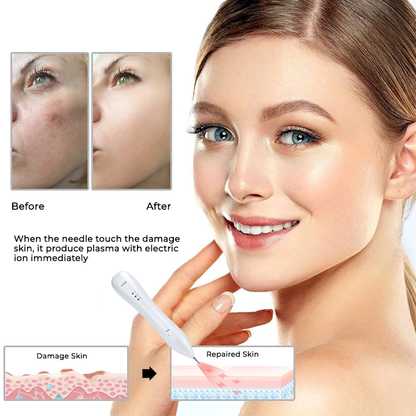 Advanced Plasma Laser Spot Cleaning Pen