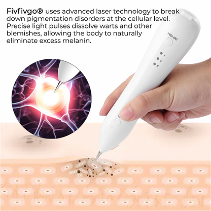 Advanced Plasma Laser Spot Cleaning Pen