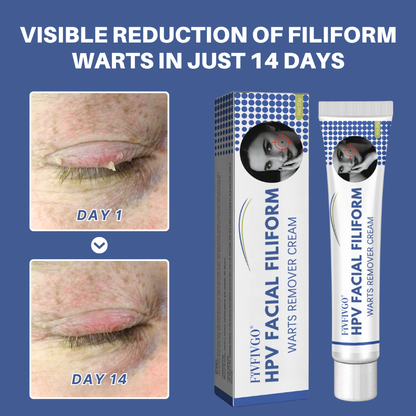 HPV Facial Filiform Warts Removal Cream PRO