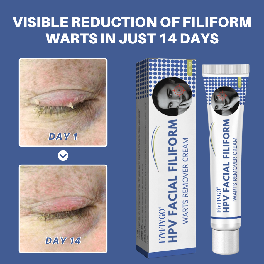 HPV Facial Filiform Warts Removal Cream