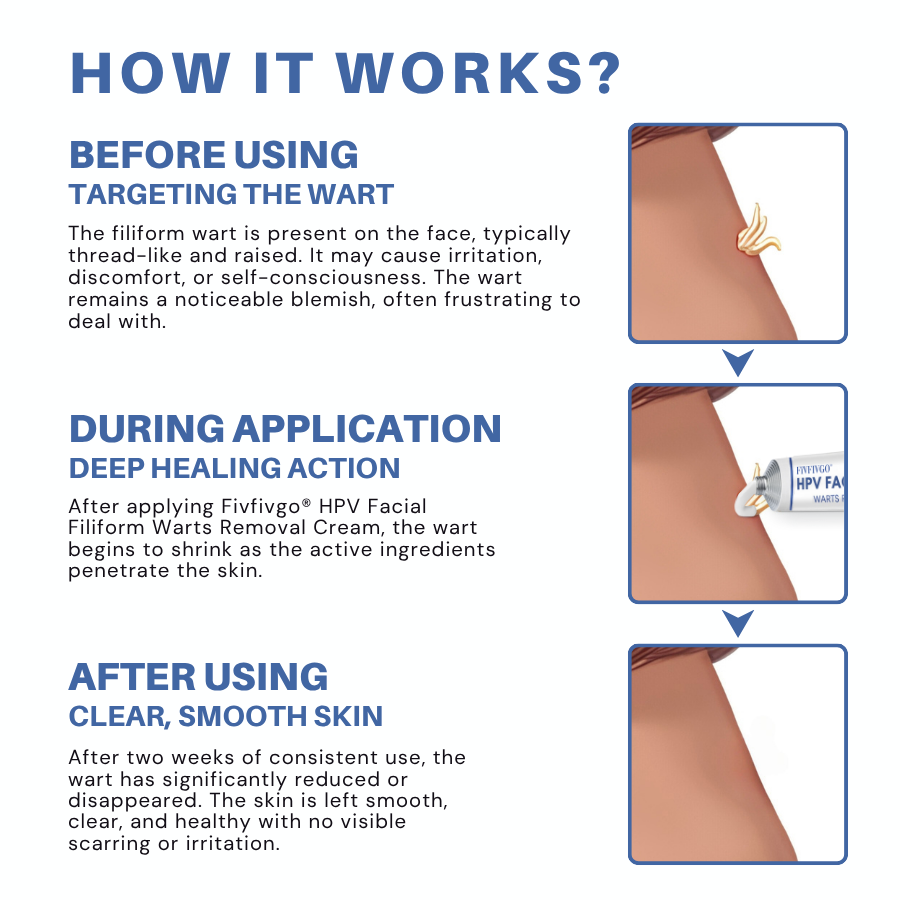 HPV Facial Filiform Warts Removal Cream PRO