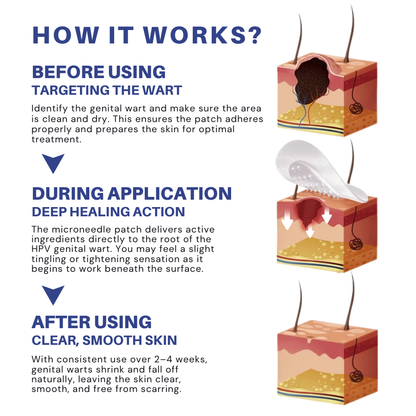 Microneedle HPV Genital Warts Removal Patch PRO