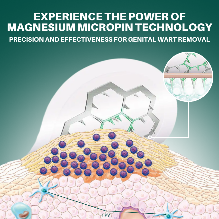 Magnesium MicroPin HPV Genital Wart Removal Patch