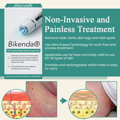 HPV Genital Warts Removal Laser Pen