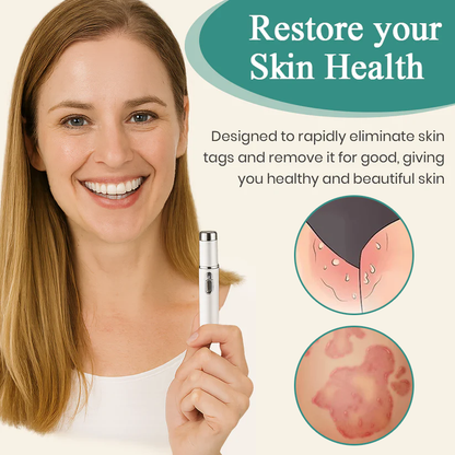 HPV Genital Warts Removal Laser Pen