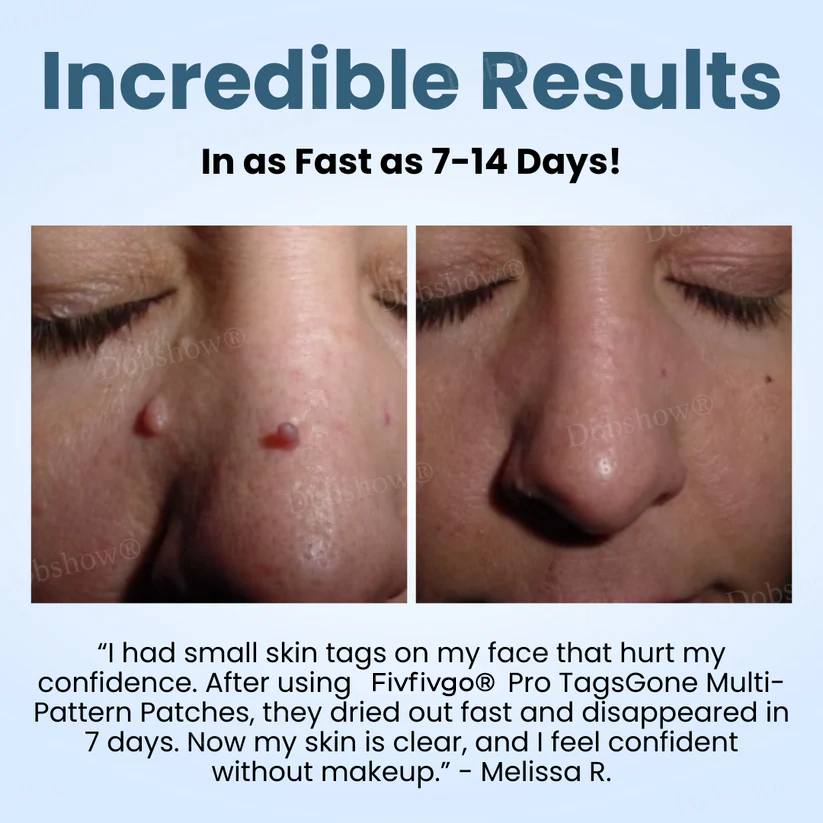 Pro TagsGone Multi-Pattern Patches