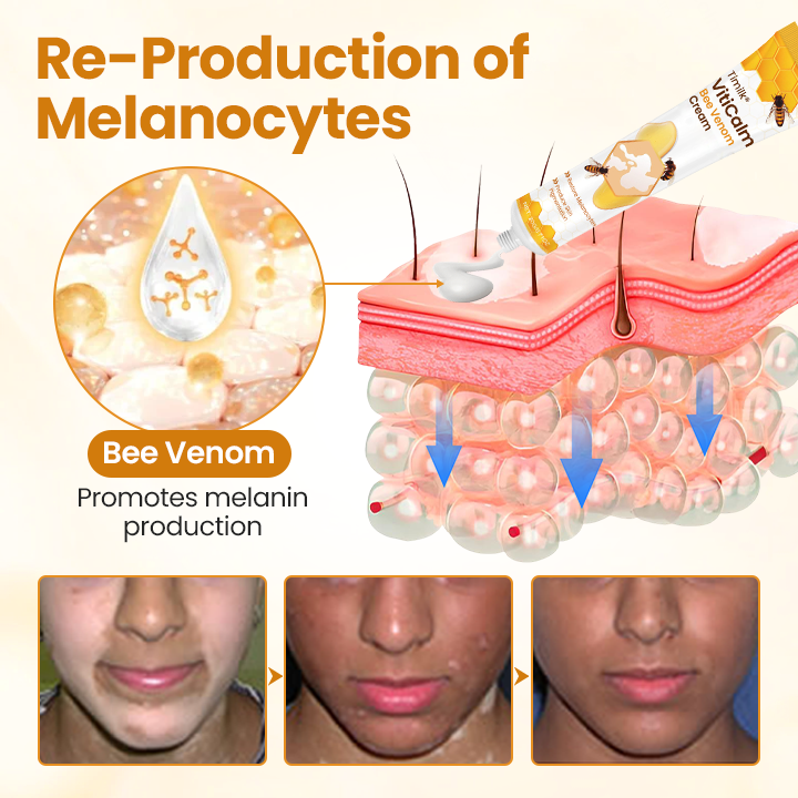 VitiCalm Bee Venom Cream