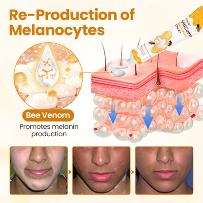 VitiCalm Bee Venom Cream