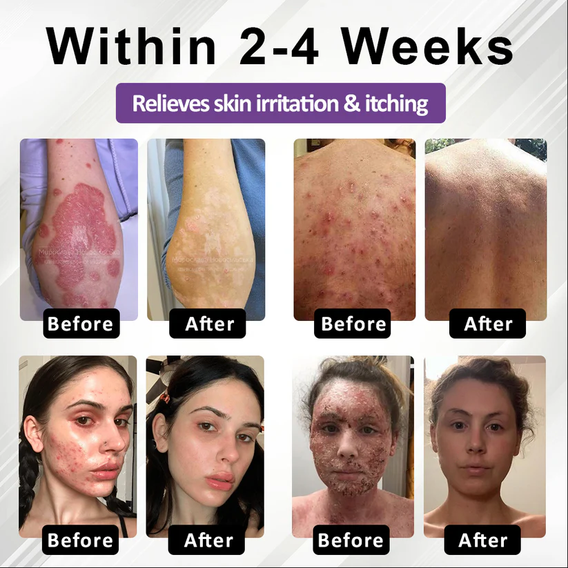 Purple Corn Multi-Condition Skin Spray