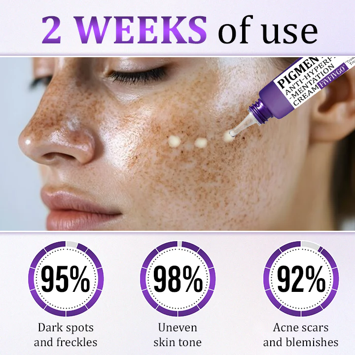 PigmentaX ProFade Anti-Hyperpigmentation Cream