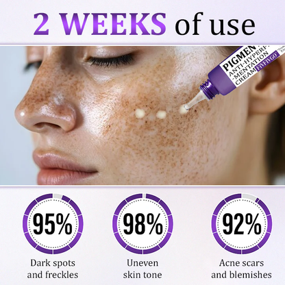 PigmentaX ProFade Anti-Hyperpigmentation Cream