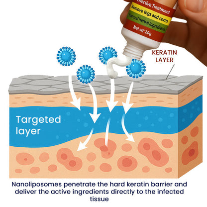 FemGenital Wart Remover Cream