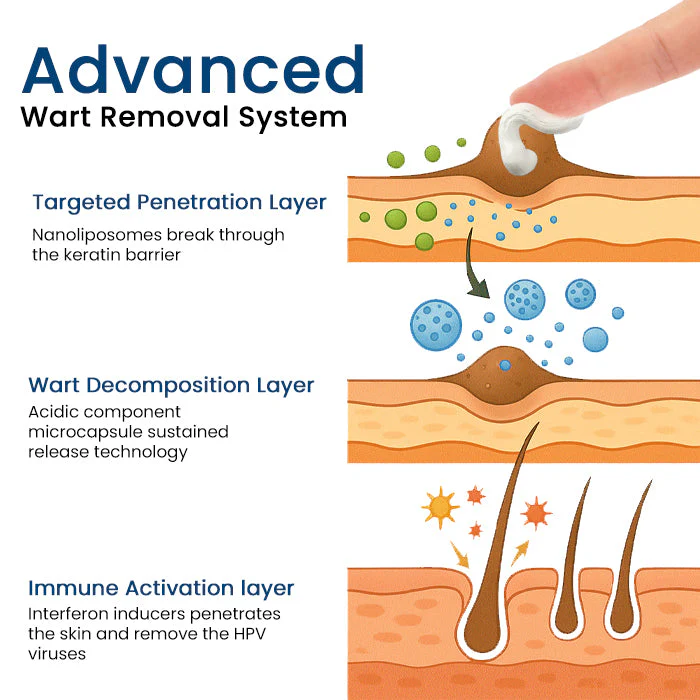 Herbal Genital Skin Treatment Cream ✅ Revolutionary Natural Solution for Genital Wart Treatment!