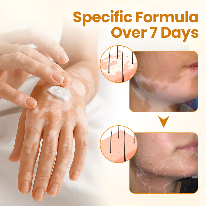 VitiCalm Bee Venom Cream