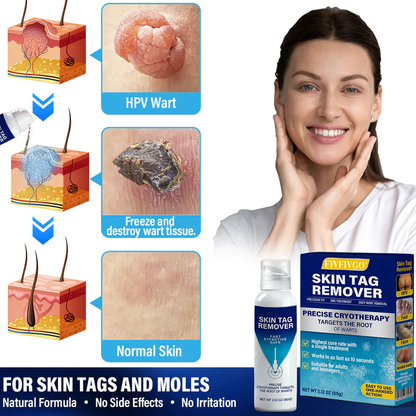 TagRecede Cryo Treatment Spray