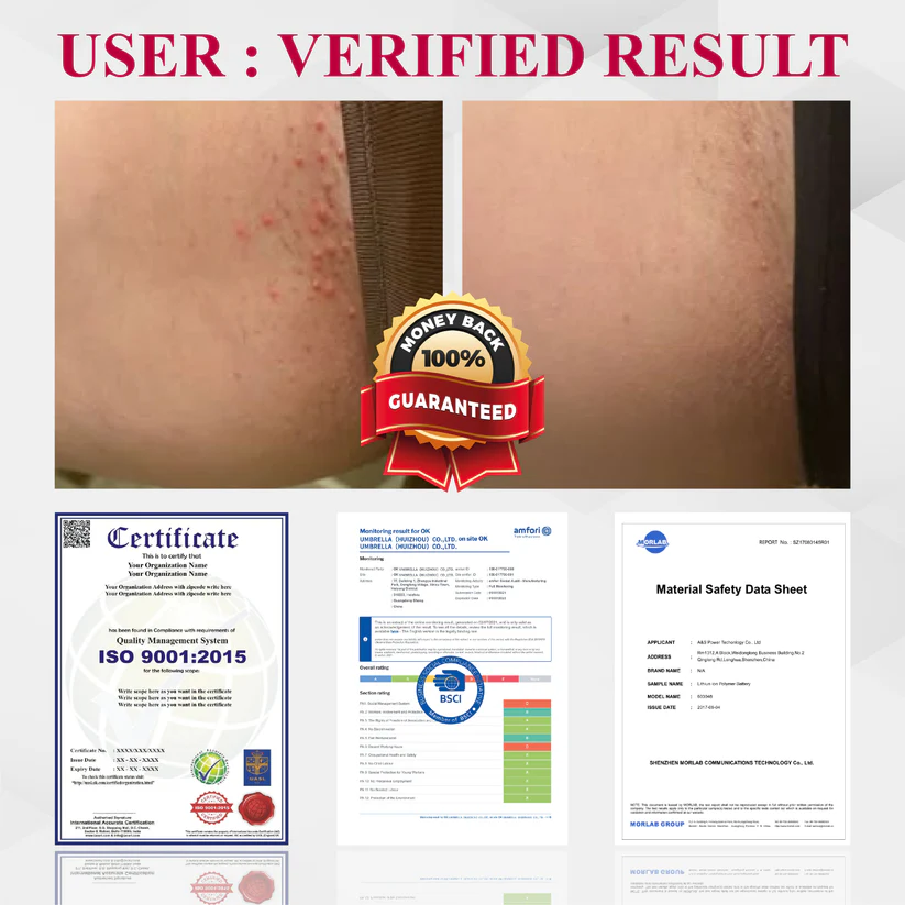 Woman's Genital HPV Healing Cream