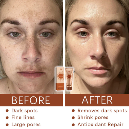 Herbal Spots Peel-Off Facial Mask PRO