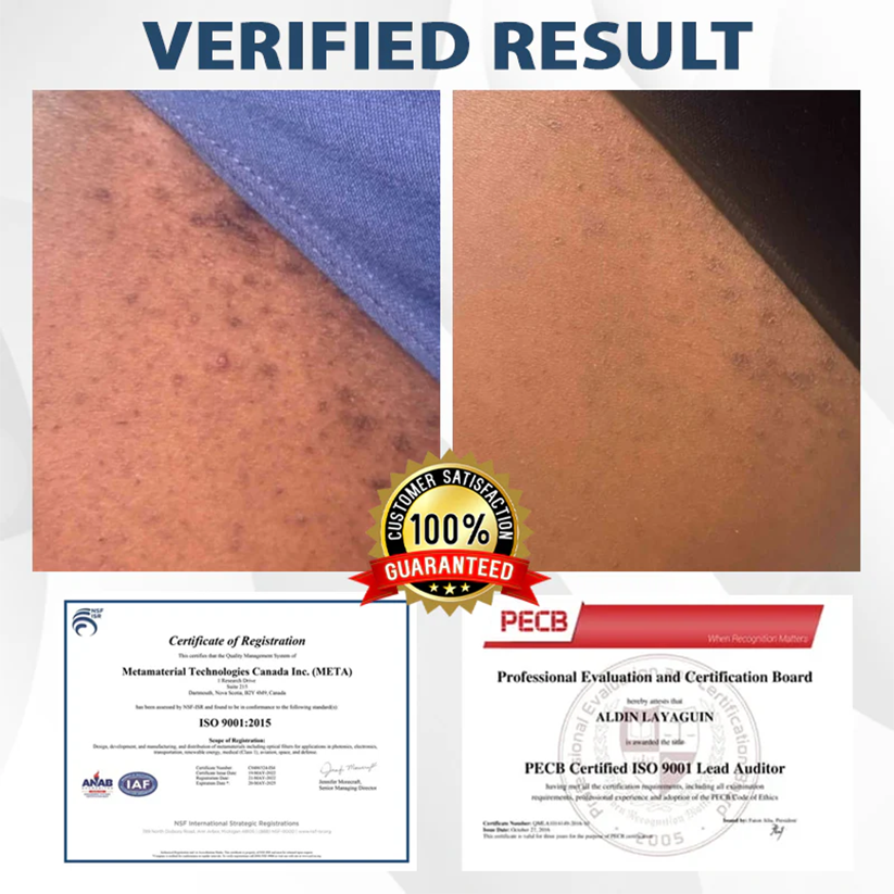 ManGuard HPV WART Healing Cream