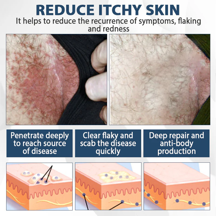 ManGuard HPV WART Healing Cream