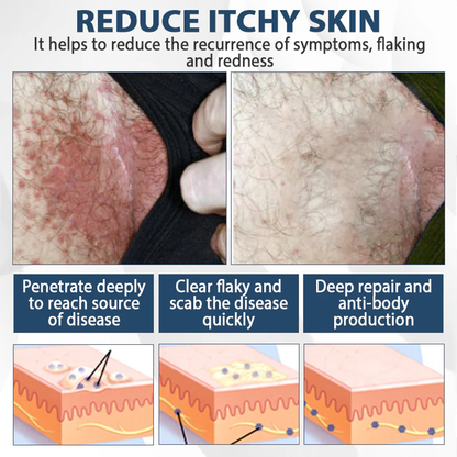 ManGuard HPV WART Healing Cream