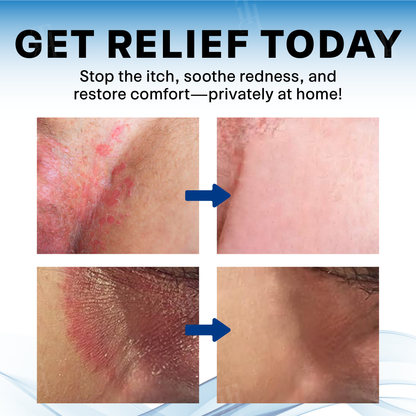 Scrotum Itchy Treatment Cream