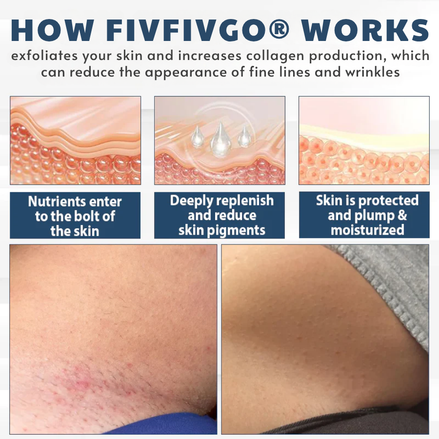 LicorRelief Man Genital Antifungal Cream