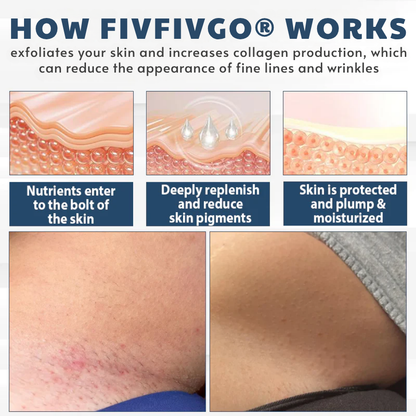 LicorRelief Man Genital Antifungal Cream