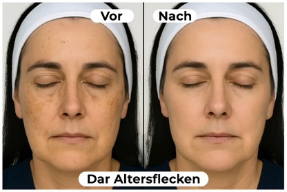 Gefriergetrocknetes Anti-Falten Nano-Seiden-Kollagen