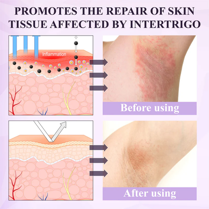 Purple Corn Multi-Condition Skin Spray