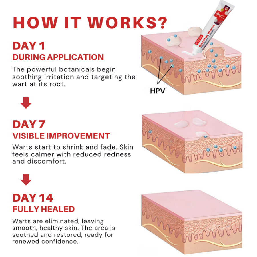 FloraGuard HPV Genital Warts Remover