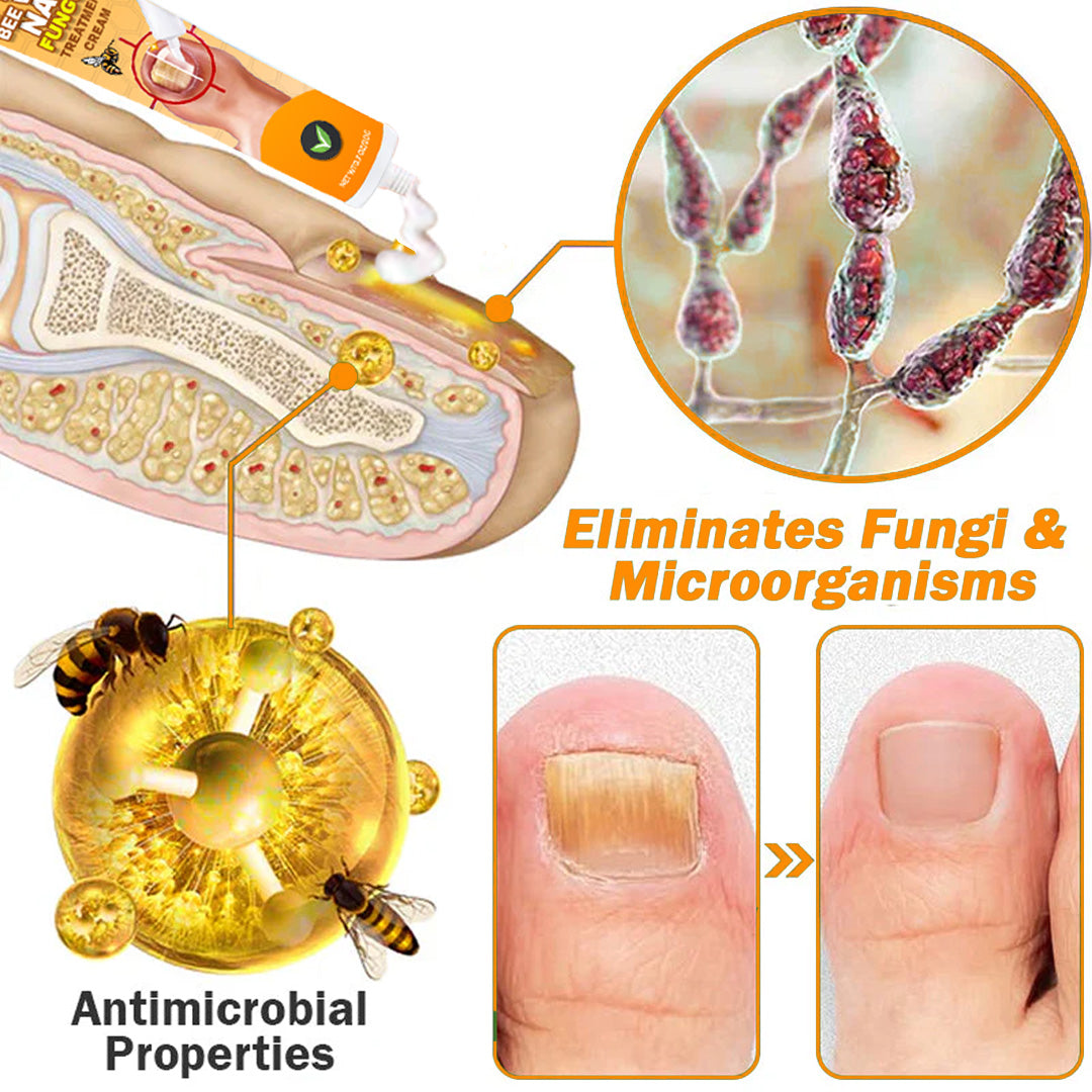 💥2025 Limited 70% OFF⏳ Kolirin Bee Venom Nail Fungus Treatment Cream