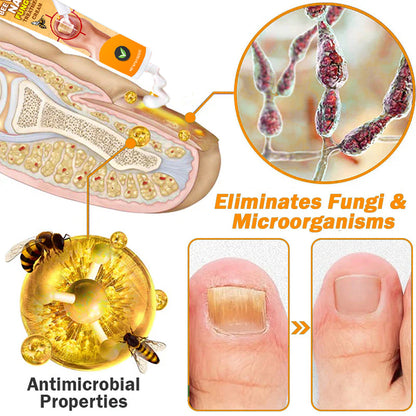 💥2025 Limited 70% OFF⏳ Kolirin Bee Venom Nail Fungus Treatment Cream