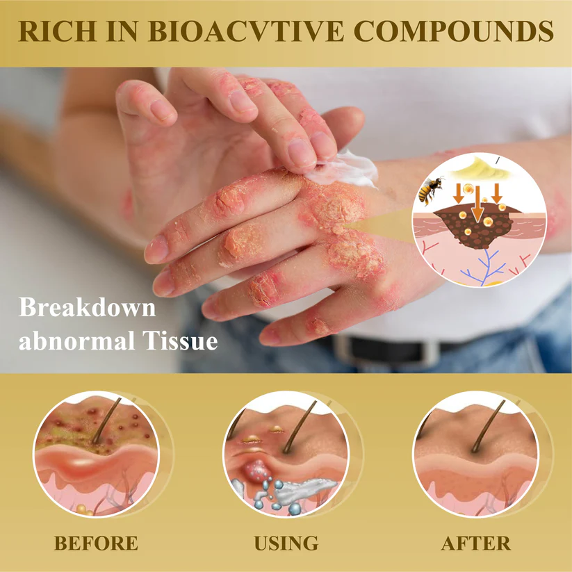 Condense Mellifera Venom Skin Repairing Cream