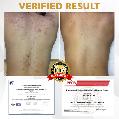 Advanced Mole & Spot Correcting Bee Gel