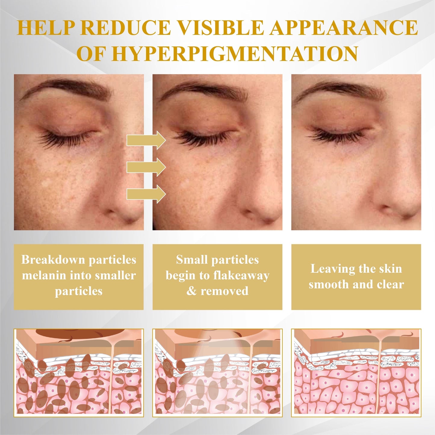 Advanced Mole & Spot Correcting Bee Gel