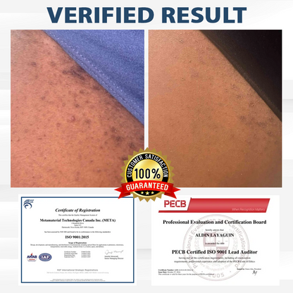 LicorRelief Man Genital Antifungal Cream