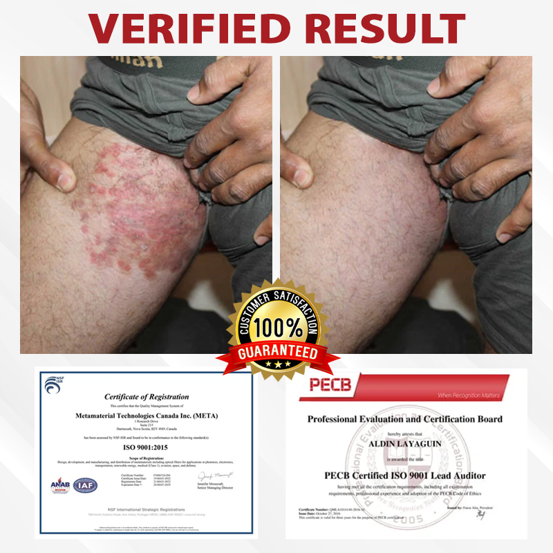 Men's HPV Warts Care Spray