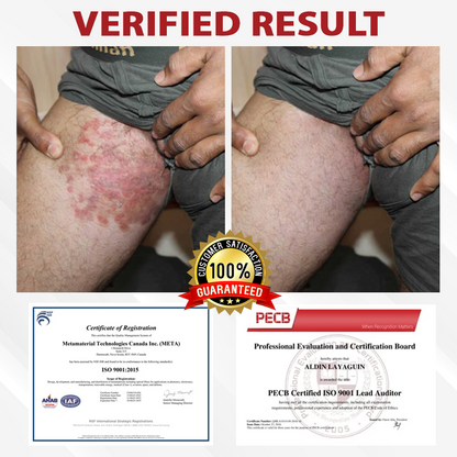 Men's HPV Warts Care Spray